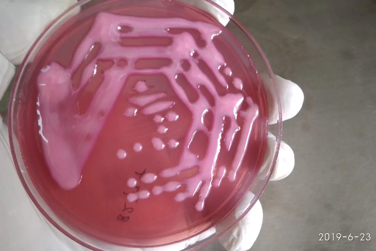 colonies-of-Klebsiella-pneumoniae-bacteria-